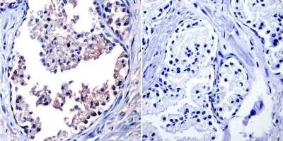 Immunohistochemistry-Paraffin: TIMP-1 Antibody (F31 P2 A5) [NB100-74551]