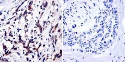 Immunohistochemistry-Paraffin: TIMP-1 Antibody (F31 P2 A5) [NB100-74551]