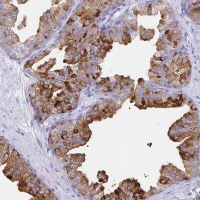 Immunohistochemistry-Paraffin: TIMP-1 Antibody [NBP2-38700]