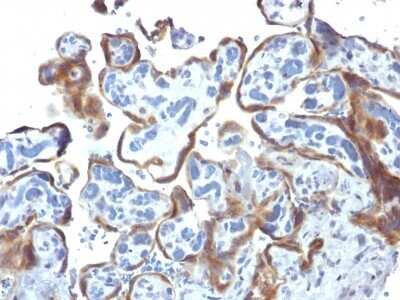 Immunohistochemistry-Paraffin: TIMP-2 Antibody (3A4) [NBP2-53347]