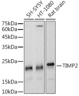 Western Blot: TIMP-2 Antibody (5P3T3) [NBP3-16074]