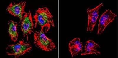 Immunocytochemistry/ Immunofluorescence: TIMP-2 Antibody (F27 P3 A4) [NB100-74552]