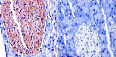 Immunohistochemistry-Paraffin: TIMP-2 Antibody (F27 P3 A4) [NB100-74552]