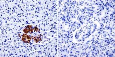 Immunohistochemistry-Paraffin: TIMP-2 Antibody (F27 P3 A4) [NB100-74552]