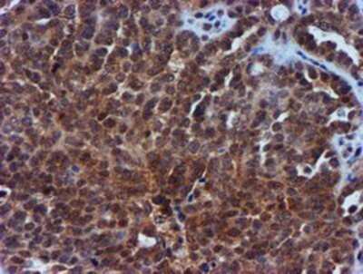 Immunohistochemistry: TIMP-2 Antibody (OTI1A6) - Azide and BSA Free [NBP2-74521]