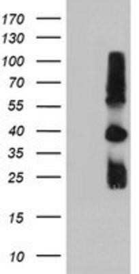 Western Blot: TIMP-2 Antibody (OTI1A6)Azide and BSA Free [NBP2-74521]