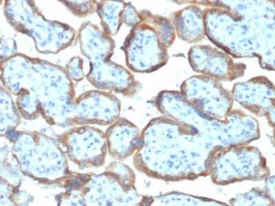 Immunohistochemistry-Paraffin: TIMP-2 Antibody (TIMP2/2044) [NBP3-07720]