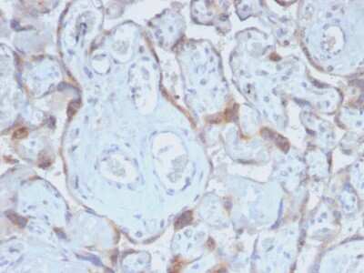 Immunohistochemistry-Paraffin: TIMP-2 Antibody (TIMP2/2488R) - Azide and BSA Free [NBP3-08721]