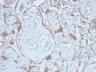 Immunohistochemistry-Paraffin: TIMP-2 Antibody (TIMP2/2488R) [NBP3-07724]