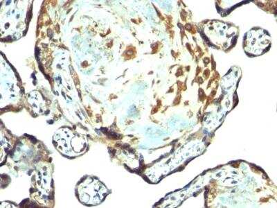 Immunohistochemistry-Paraffin: TIMP-3 Antibody - Azide and BSA Free [NBP2-33098]