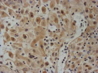 Immunohistochemistry-Paraffin: TIMP-3 Antibody - IHC-Prediluted [NBP2-48469]