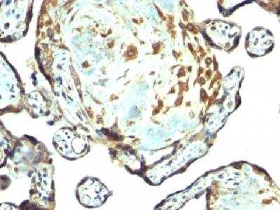 Immunohistochemistry-Paraffin: TIMP-3 Antibody [NBP2-29478]
