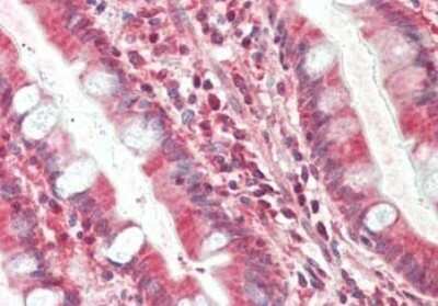 Immunohistochemistry: TIMP-4 Antibody (9:4-7) [NBP2-21658]