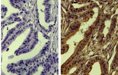 Immunohistochemistry-Paraffin: TIMP-4 Antibody (SB30c) - Azide and BSA Free [NBP1-28619]
