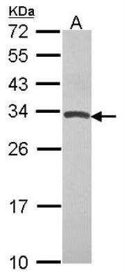 Western Blot: TIMP-4 Antibody [NBP2-20645]