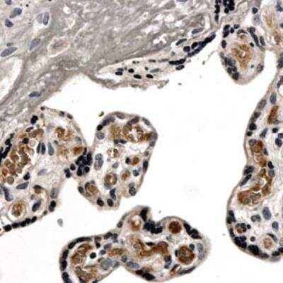 Immunohistochemistry-Paraffin: TIMP-1 Antibody (MM0034-4A16) - Azide and BSA Free [NB110-61000]