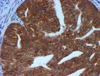 Immunohistochemistry-Paraffin: TIMP-2 Antibody (OTI1A6) [NBP2-01573]