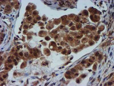 Immunohistochemistry-Paraffin: TIMP-2 Antibody (OTI1A6) [NBP2-01573]
