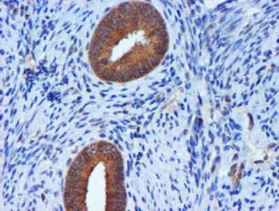 Immunohistochemistry-Paraffin: TIMP-2 Antibody (OTI1A6) [NBP2-01573]