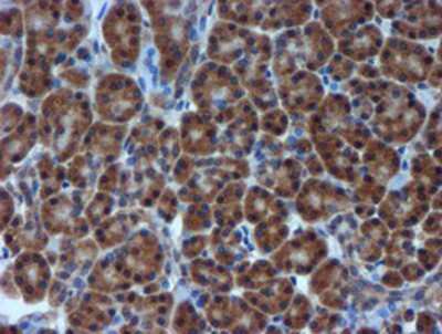 Immunohistochemistry-Paraffin: TIMP-2 Antibody (OTI1A6) [NBP2-01573]