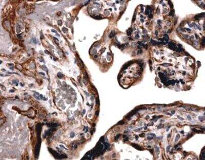 Immunohistochemistry-Paraffin: TIMP-2 Antibody (MM0035-2C13) - Azide and BSA Free [NB110-61001]