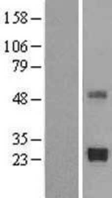 Western Blot: TIMP-2 Overexpression Lysate [NBL1-16925]