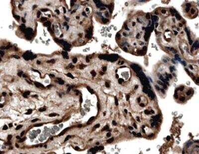 Immunohistochemistry-Paraffin: TIMP-3 Antibody (MM0036-7D3) - Azide and BSA Free [NB110-61002]