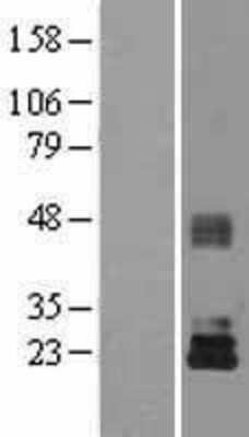 Western Blot: TIMP-3 Overexpression Lysate [NBL1-16926]