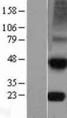 Western Blot: TIMP-4 Overexpression Lysate [NBL1-16927]