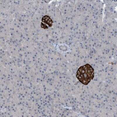 Immunohistochemistry-Paraffin: TIN-Ag Antibody [NBP1-86307]