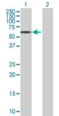 Western Blot: TIN-Ag Antibody [H00027283-B01P]