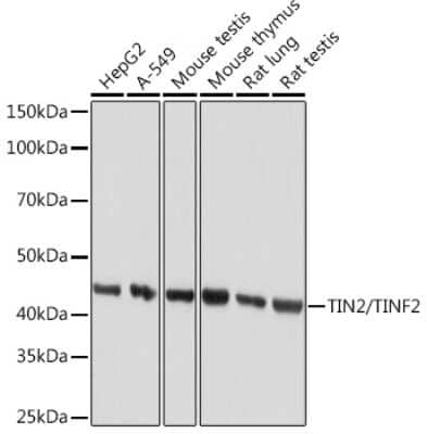 Western Blot: TIN2 Antibody (4W5P2) [NBP3-16874]