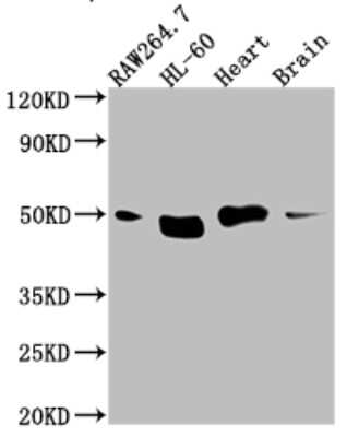 Western Blot: TIN2 Antibody (5G11) [NBP3-15221]