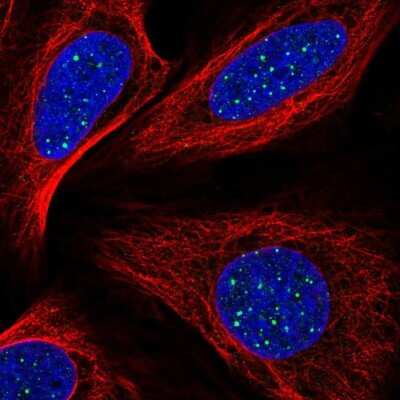 Immunocytochemistry/ Immunofluorescence: TIN2 Antibody [NBP2-55709]