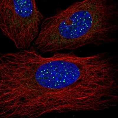 Immunocytochemistry/ Immunofluorescence: TIN2 Antibody [NBP2-56834]