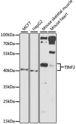 Western Blot: TIN2 AntibodyBSA Free [NBP2-95205]