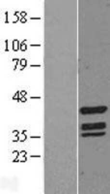 Western Blot: TIN2 Overexpression Lysate [NBL1-16930]