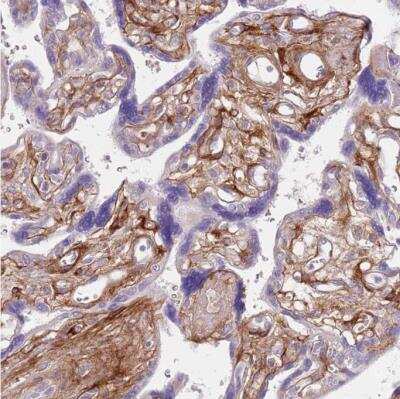 Immunohistochemistry-Paraffin: TINAGL1 Antibody [NBP2-13434]