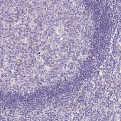 Immunohistochemistry-Paraffin: TINAGL1 Antibody [NBP2-13434]