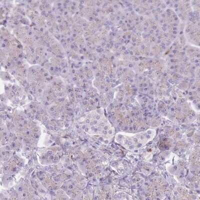 Immunohistochemistry-Paraffin: TINAGL1 Antibody [NBP2-13434]