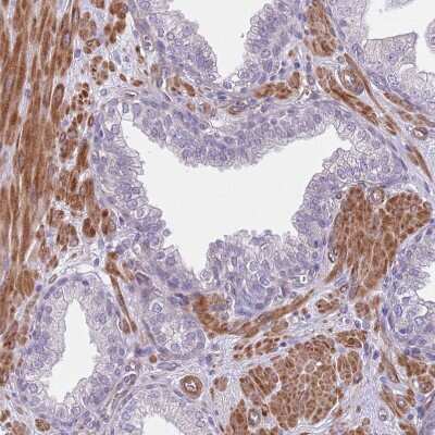 Immunohistochemistry-Paraffin: TINAGL1 Antibody [NBP2-13434]