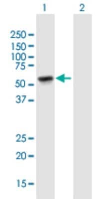 Western Blot: TINAGL1 Antibody [H00064129-B02P]