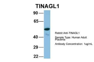 Western Blot: TINAGL1 Antibody [NBP1-57765]