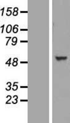 Western Blot: TINAGL1 Overexpression Lysate [NBL1-16929]