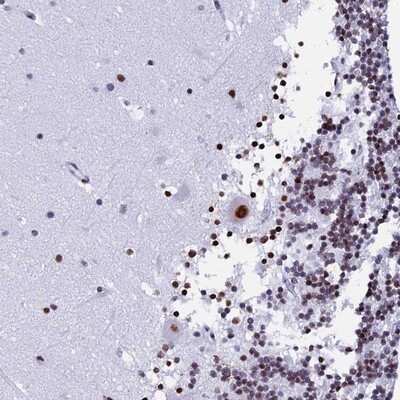 Immunohistochemistry-Paraffin: TINP1 Antibody [NBP2-13675]