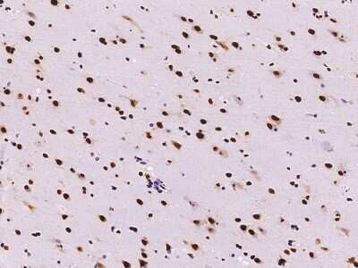 Immunohistochemistry-Paraffin: TINP1 Antibody [NBP2-99405]