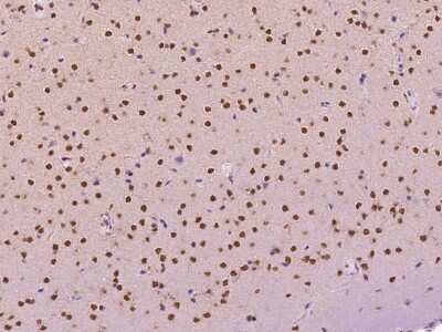 Immunohistochemistry-Paraffin: TINP1 Antibody [NBP2-99405]