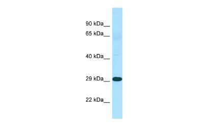 Western Blot: TINP1 Antibody [NBP2-85920]