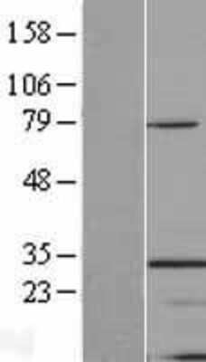 Western Blot: TINP1 Overexpression Lysate [NBL1-16931]