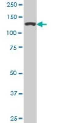 Western Blot: TIP120A Antibody (1G5) [H00055832-M05]